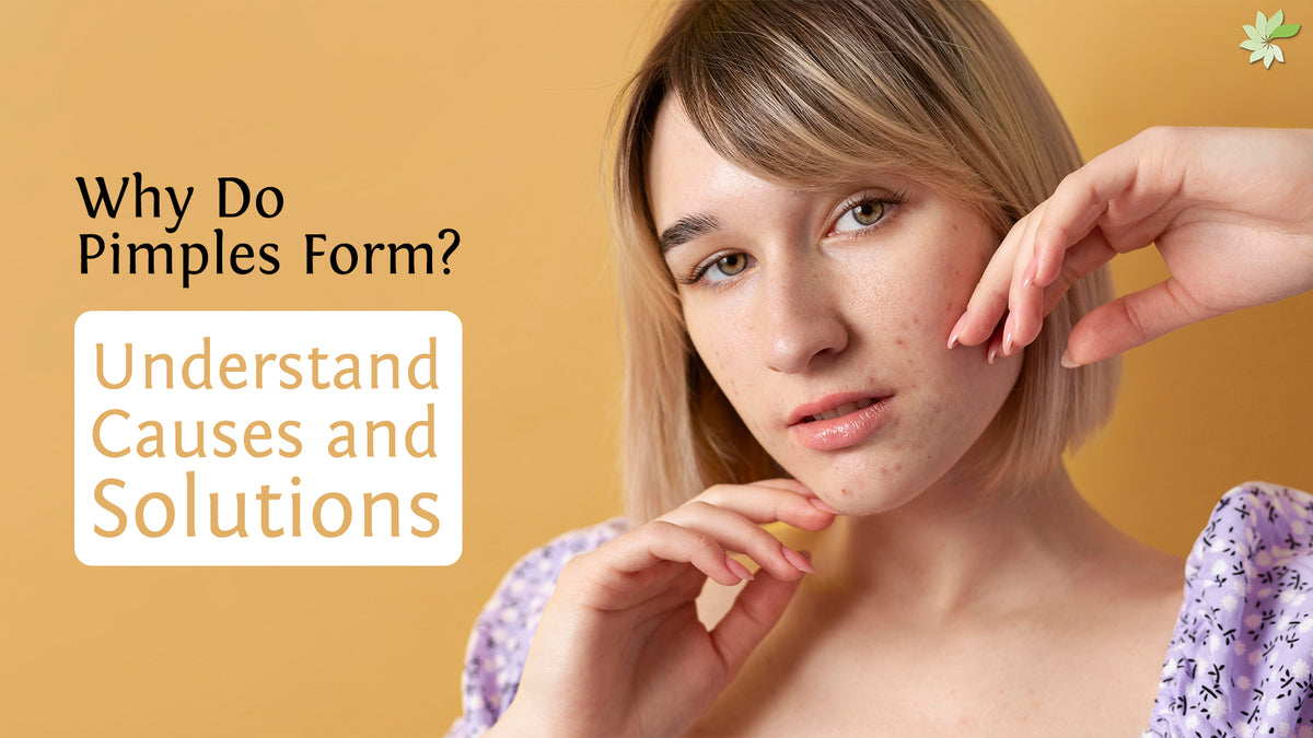 Does Pimples Help Why Do Pimples Form? Understand Causes and Solutions – minaturewellness